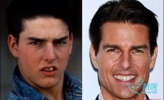 男明星矫正,男明星矫正之路，蜕变重生记