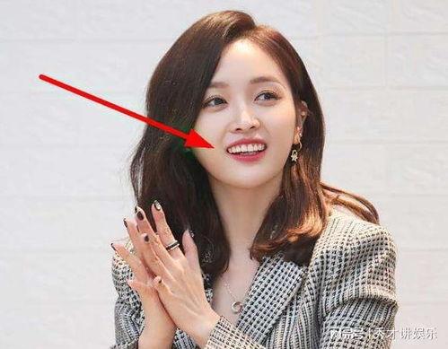 女明星 假牙,美丽背后的秘密武器
