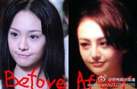 女嘉宾整容爆料完整视频,完整视频曝光，惊人内幕曝光